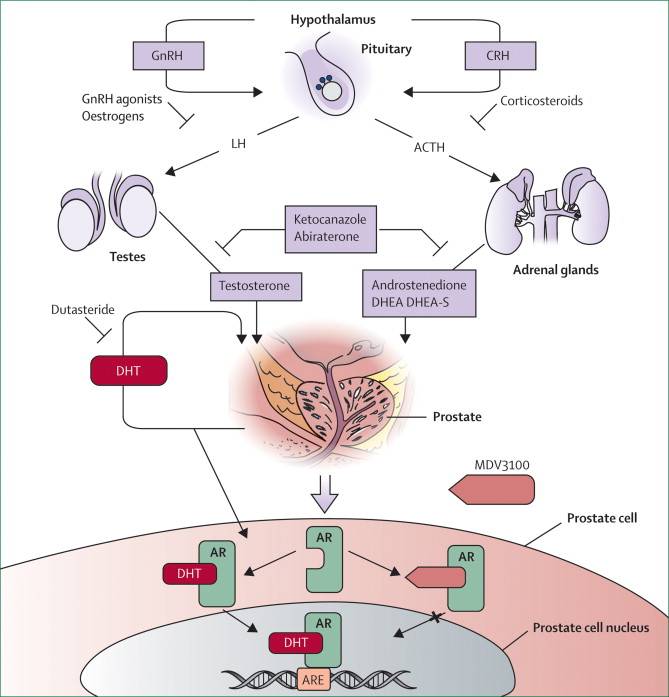 What is Hereditary Angioedema?