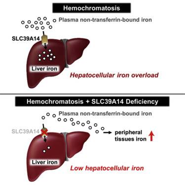 What is Hemochromatosis?