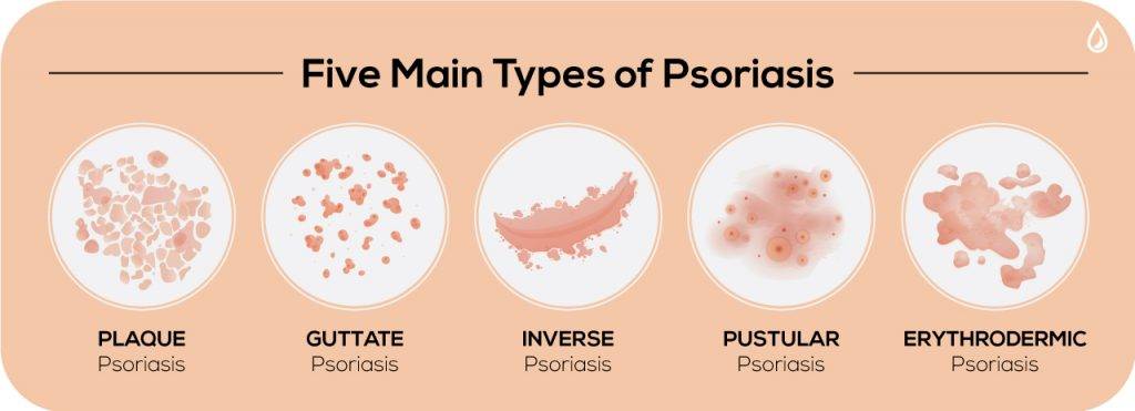 What is Psoriasis?