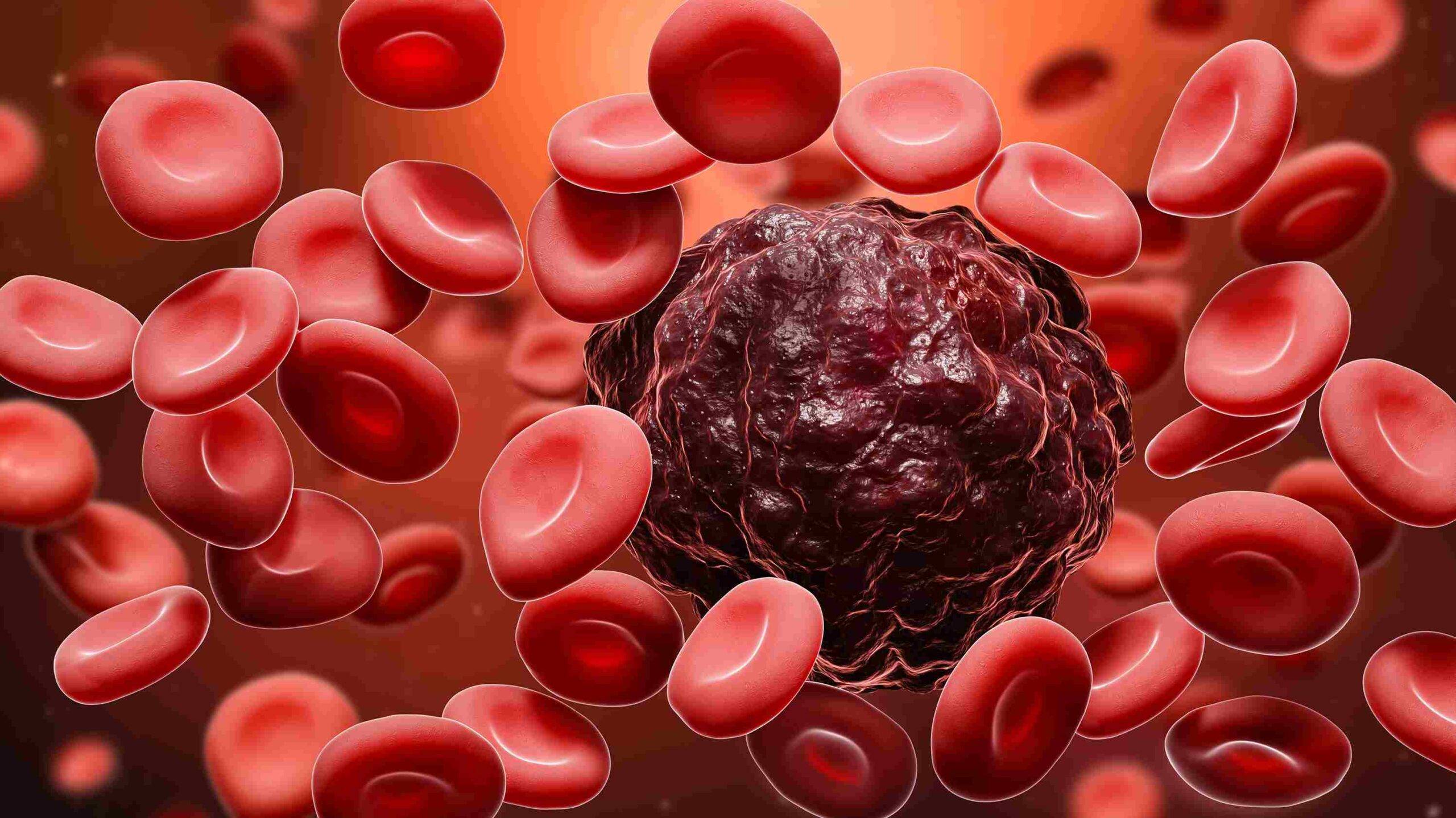 What is Blood cancer?