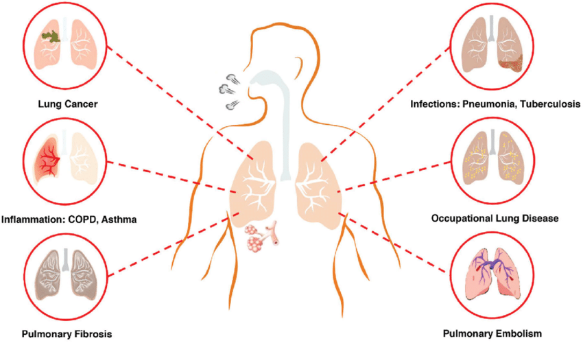 What is Lung disease?