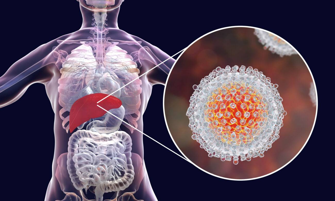 what is Hepatitis B