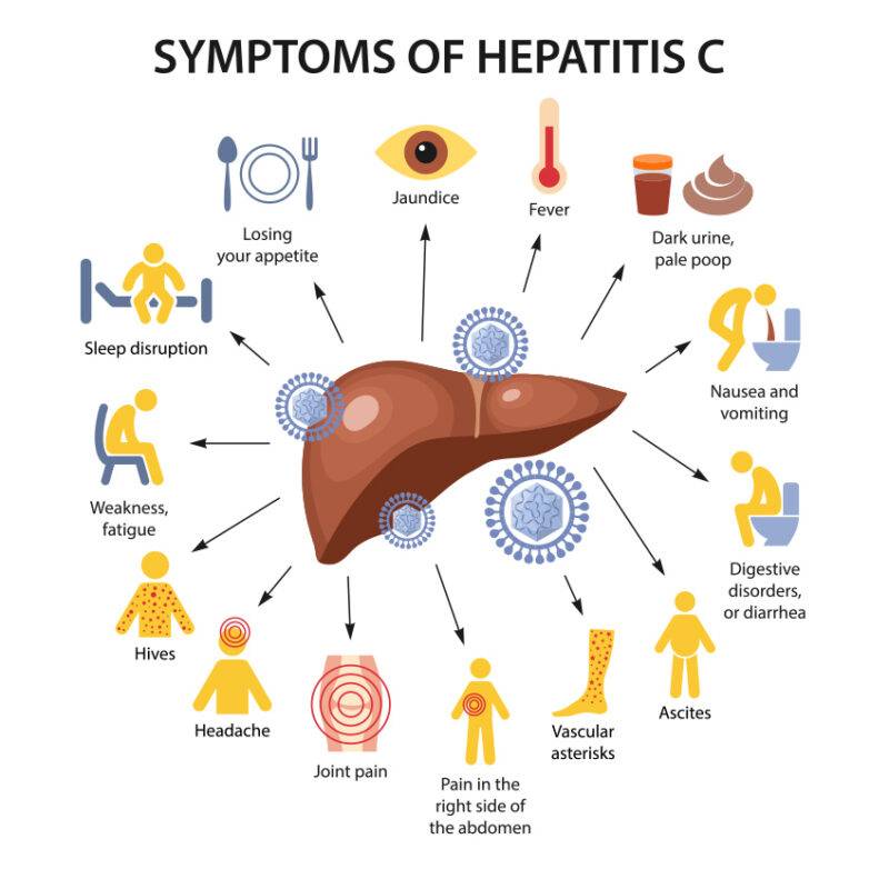 what is Hepatitis C?