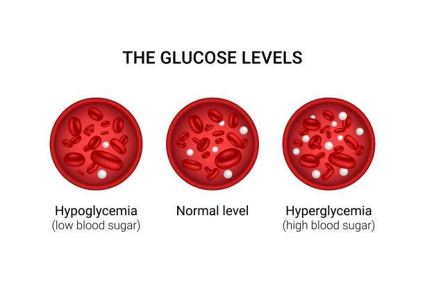 What is Hypoglycemia ?