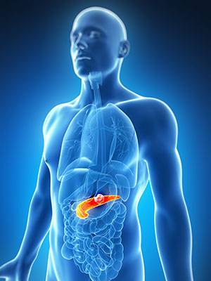 What is Pancreatic Cancer?