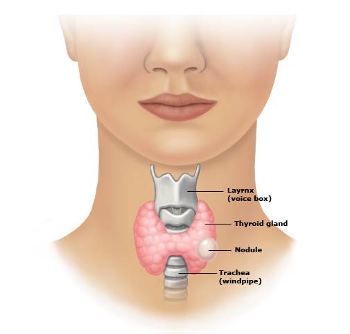 What is Thyroid cancer ?